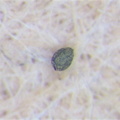 Drosera burmannii seed testa 100x