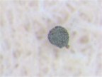Drosera glanduligera seed testa scan 100xa